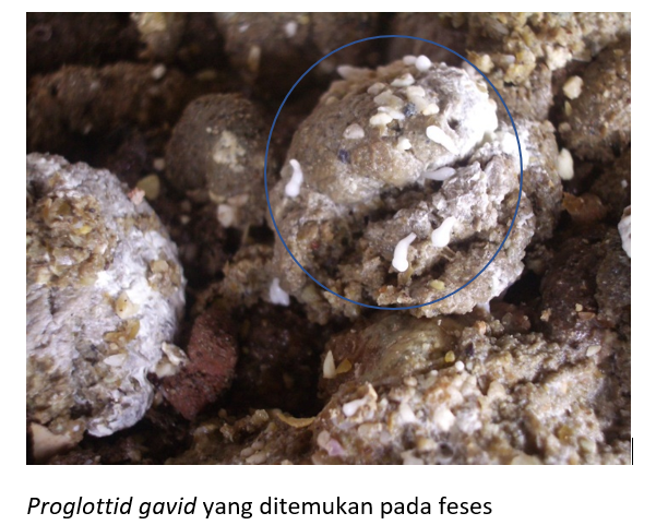 Proglottid gavid yang ditemukan pada feses